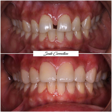 Slider image (4) FMS Dental Hospital - Kukatpally